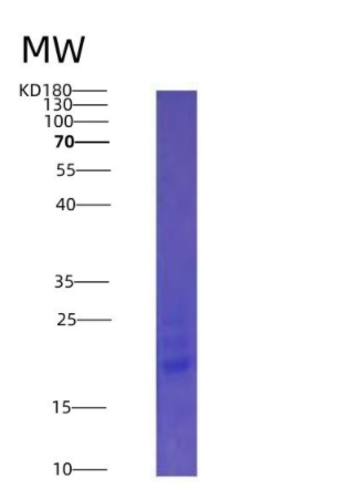 Eukaryotic Interleukin 25 (IL25),Eukaryotic Interleukin 25 (IL25)