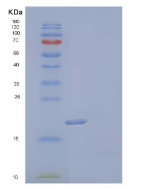 Recombinant Human Uridine Phosphorylase 1/UPP1 Protein(N-6His),Recombinant Human Uridine Phosphorylase 1/UPP1 Protein(N-6His)