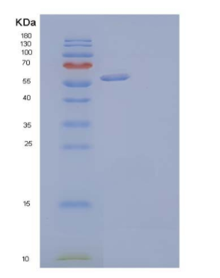 Recombinant Human Dickkopf-Related Protein 2/DKK-2 Protein(N-Fc, C-6His),Recombinant Human Dickkopf-Related Protein 2/DKK-2 Protein(N-Fc, C-6His)