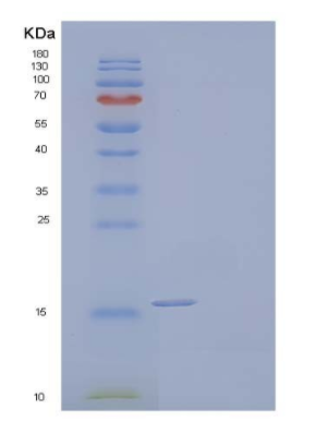 Recombinant Human Allograft Inflammatory Factor 1/AIF1 Protein(C-6His),Recombinant Human Allograft Inflammatory Factor 1/AIF1 Protein(C-6His)