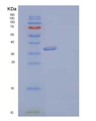 Recombinant Human Aldo-Keto Reductase 1C3/AKR1C3 Protein(C-6His),Recombinant Human Aldo-Keto Reductase 1C3/AKR1C3 Protein(C-6His)