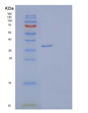 Recombinant Human Dickkopf-Related Protein 3/DKK3 Protein(C-6His),Recombinant Human Dickkopf-Related Protein 3/DKK3 Protein(C-6His)