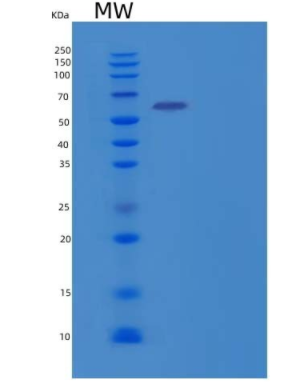 Recombinant Human Butyrylcholine Esterase Protein,Recombinant Human Butyrylcholine Esterase Protein