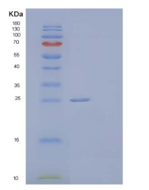 Recombinant Human Ribulose-Phosphate 3-Epimerase Protein,Recombinant Human Ribulose-Phosphate 3-Epimerase Protein