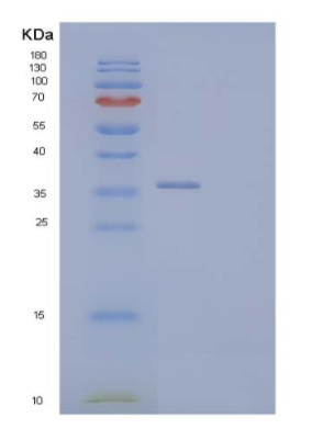 Recombinant Human Poliovirus Receptor-Related Protein 2/PVRL2/CD112 Protein(C-6His),Recombinant Human Poliovirus Receptor-Related Protein 2/PVRL2/CD112 Protein(C-6His)
