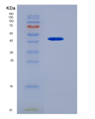 Recombinant Interleukin 3 (IL3),Recombinant Interleukin 3 (IL3)