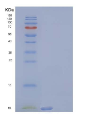 Recombinant Human Uteroglobin-Related Protein 1/UGRP1 Protein,Recombinant Human Uteroglobin-Related Protein 1/UGRP1 Protein