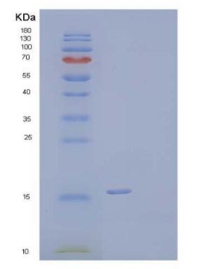 Recombinant Human Vasoactive Intestinal Peptide/VIP Protein(C-6His),Recombinant Human Vasoactive Intestinal Peptide/VIP Protein(C-6His)