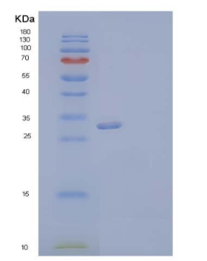 Recombinant Human VIP36-Like Protein/LMAN2L Protein(C-6His),Recombinant Human VIP36-Like Protein/LMAN2L Protein(C-6His)