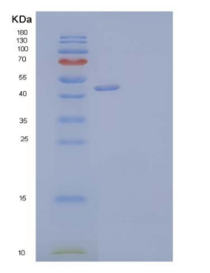 Recombinant Human Vascular Non-Inflammatory Molecule 2 Protein,Recombinant Human Vascular Non-Inflammatory Molecule 2 Protein