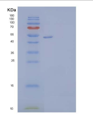 Recombinant Human Vitronectin/VTN Protein(C-6His),Recombinant Human Vitronectin/VTN Protein(C-6His)