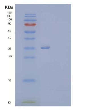Recombinant Human Annexin A13/ANXA13 Protein,Recombinant Human Annexin A13/ANXA13 Protein