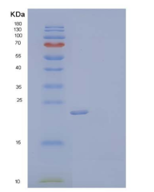 Recombinant Mouse Protein CREG1/CREG Protein(C-6His),Recombinant Mouse Protein CREG1/CREG Protein(C-6His)