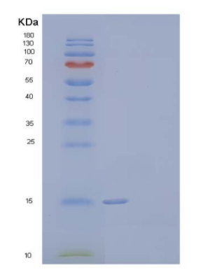 Recombinant Human Prion-Like Protein Doppel/PRND Protein(C-6His),Recombinant Human Prion-Like Protein Doppel/PRND Protein(C-6His)