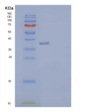 Recombinant Human Annexin A2/ANXA2 Protein,Recombinant Human Annexin A2/ANXA2 Protein