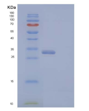 Recombinant Human V-Set and Ig Domain-Containing Protein 8/VSIG8 Protein(C-6His),Recombinant Human V-Set and Ig Domain-Containing Protein 8/VSIG8 Protein(C-6His)
