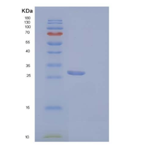 Recombinant Mouse Insulin-like Growth Factor-Binding Protein 5/IGFBP5 Protein(C-6His)