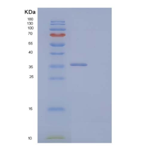 Recombinant Human Cyclin-D2/CCND2 Protein(N-6His)