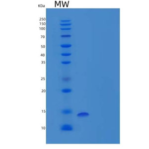 Recombinant Human Peptidyl-Prolyl Cis-Trans Isomerase FKBP2/FKBP22/FKBP13 Protein(C-6His)