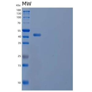 Recombinant Mouse Interleukin-22/IL-22 Protein(C-mFc)