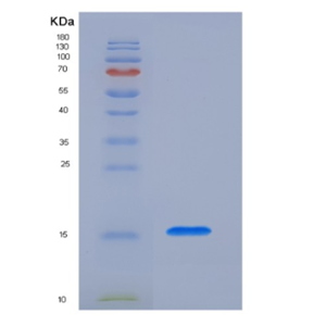 Recombinant Human PH-Like Domain A2/PHLDA2/BWR1C/IPL/TSSC3 Protein(C-6His)