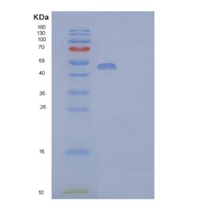 Recombinant Human Aldehyde dehydrogenase family 3 member A1 Protein