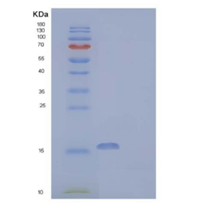 Recombinant Human Acyl-Coenzyme A Thioesterase 13/ACOT13 Protein(C-6His)