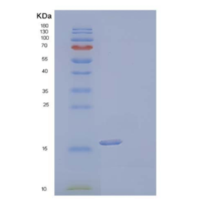 Recombinant Human Interleukin-17F/INHAProtein(C-6His),Recombinant Human Interleukin-17F/INHAProtein(C-6His)