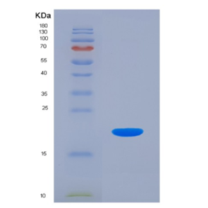 Eukaryotic Interleukin 18 (IL18),Eukaryotic Interleukin 18 (IL18)