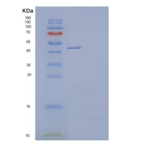Recombinant Human Deoxyhypusine Synthase/DHS Protein(C-6His)