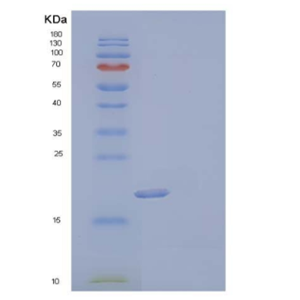 Recombinant Human Uridine Phosphorylase 1/UPP1 Protein(N-6His)