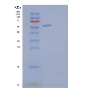 Recombinant Human Dickkopf-Related Protein 2/DKK-2 Protein(N-Fc, C-6His)