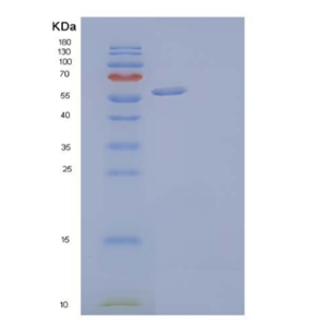 Recombinant Human Dickkopf-Related Protein 2/DKK-2 Protein(N-Fc, C-6His),Recombinant Human Dickkopf-Related Protein 2/DKK-2 Protein(N-Fc, C-6His)