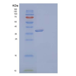 Recombinant Human Aldo-Keto Reductase 1C3/AKR1C3 Protein(C-6His)
