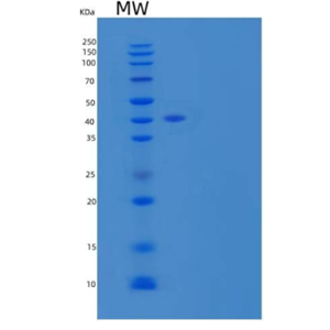 Recombinant Human Dipeptidyl-Peptidase 1/DPP1 Protein(C-6His)