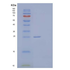 Recombinant Human Ribulose-Phosphate 3-Epimerase Protein