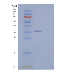Recombinant Human Poliovirus Receptor-Related Protein 2/PVRL2/CD112 Protein(C-6His)