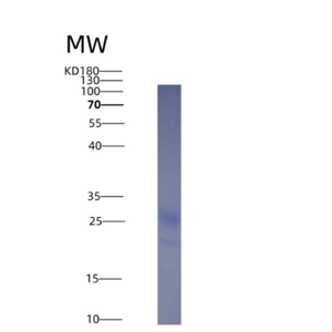 Eukaryotic Tumor Necrosis Factor Ligand Superfamily, Member 4 (TNFSF4)