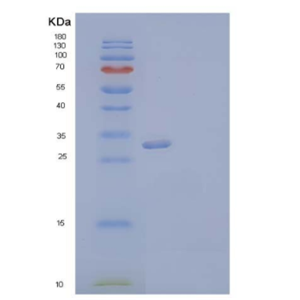 Recombinant Human VIP36-Like Protein/LMAN2L Protein(C-6His),Recombinant Human VIP36-Like Protein/LMAN2L Protein(C-6His)