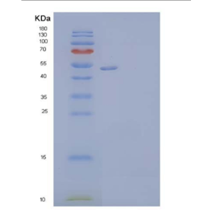 Recombinant Human Vitronectin/VTN Protein(C-6His),Recombinant Human Vitronectin/VTN Protein(C-6His)