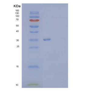 Recombinant Human Annexin A13/ANXA13 Protein