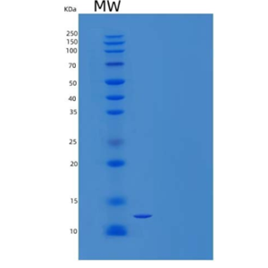 Recombinant Human V-Set and Transmembrane Domain-Containing 1/VSTM1 Protein(C-6His)