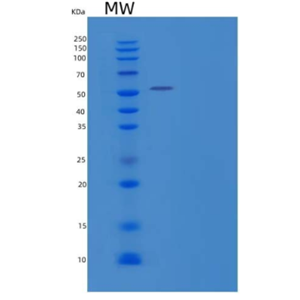 Recombinant Human V-Set and Ig Domain-Containing Protein 8/VSIG8 Protein(C-Fc)