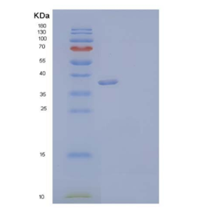 Recombinant Human Annexin A2/ANXA2 Protein