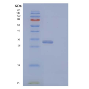 Recombinant Human V-Set and Ig Domain-Containing Protein 8/VSIG8 Protein(C-6His)