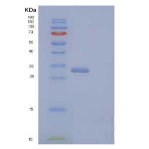 Recombinant Human V-Set and Ig Domain-Containing Protein 8/VSIG8 Protein(C-6His),Recombinant Human V-Set and Ig Domain-Containing Protein 8/VSIG8 Protein(C-6His)