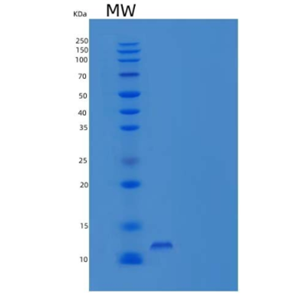 Recombinant Mouse S100 Calcium Binding Protein A8/S100A8 Protein(C-6His)