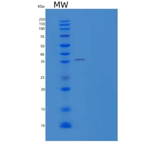 Recombinant Human Annexin A8/ANXA8 Protein