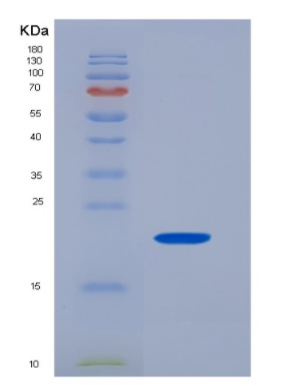 Recombinant Human CD32a / FCGR2A Protein (166 Arg, His tag),Recombinant Human CD32a / FCGR2A Protein (166 Arg, His tag)