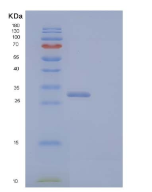 Recombinant Human Chymotrypsin-C Protein,Recombinant Human Chymotrypsin-C Protein